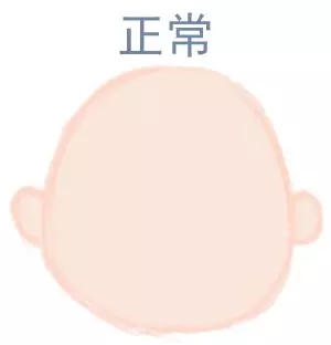 ԲͷվɱͷЩ趼֪5.webp.jpg